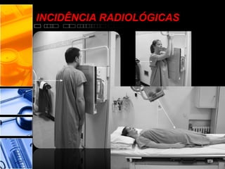 INCIDÊNCIA RADIOLÓGICAS
 