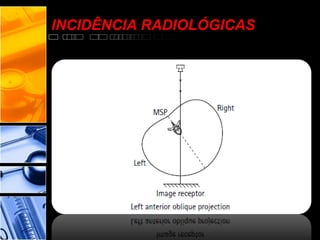 INCIDÊNCIA RADIOLÓGICAS
 