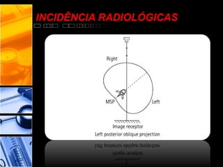 INCIDÊNCIA RADIOLÓGICAS
 