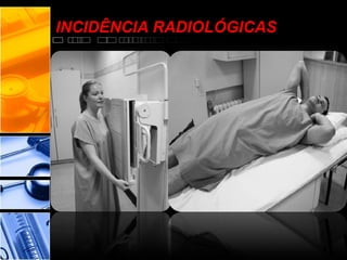 INCIDÊNCIA RADIOLÓGICAS
 