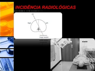 INCIDÊNCIA RADIOLÓGICAS
 