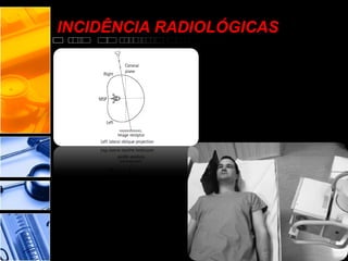 INCIDÊNCIA RADIOLÓGICAS
 