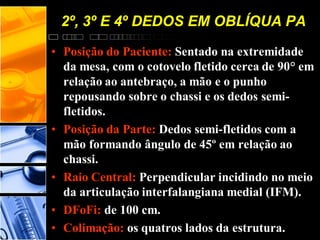 2º, 3º E 4º DEDOS EM OBLÍQUA PA
• Posição do Paciente: Sentado na extremidade
da mesa, com o cotovelo fletido cerca de 90° em
relação ao antebraço, a mão e o punho
repousando sobre o chassi e os dedos semi-
fletidos.
• Posição da Parte: Dedos semi-fletidos com a
mão formando ângulo de 45º em relação ao
chassi.
• Raio Central: Perpendicular incidindo no meio
da articulação interfalangiana medial (IFM).
• DFoFi: de 100 cm.
• Colimação: os quatros lados da estrutura.
 