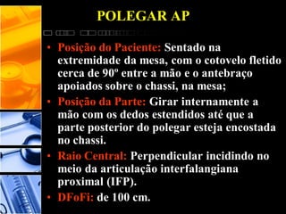POLEGAR AP
• Posição do Paciente: Sentado na
extremidade da mesa, com o cotovelo fletido
cerca de 90º entre a mão e o antebraço
apoiados sobre o chassi, na mesa;
• Posição da Parte: Girar internamente a
mão com os dedos estendidos até que a
parte posterior do polegar esteja encostada
no chassi.
• Raio Central: Perpendicular incidindo no
meio da articulação interfalangiana
proximal (IFP).
• DFoFi: de 100 cm.
 