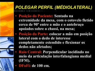 POLEGAR PERFIL (MÉDIOLATERAL)
• Posição do Paciente: Sentado na
extremidade da mesa, com o cotovelo fletido
cerca de 90º entre a mão e o antebraço
apoiados sobre o chassi, na mesa;
• Posição da Parte: colocar a mão em posição
lateral com o dedo de interesse
completamente estendido e flexionar os
dedos não afetados;
• Raio Central: Perpendicular incidindo no
meio da articulação interfalangiana medial
(IFM).
• DFoFi: de 100 cm.
 