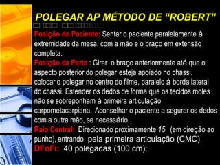 POLEGAR AP MÉTODO DE “ROBERT”
Posição do Paciente: Sentar o paciente paralelamente à
extremidade da mesa, com a mão e o braço em extensão
completa.
Posição da Parte : Girar o braço anteriormente até que o
aspecto posterior do polegar esteja apoiado no chassi.
colocar o polegar no centro do filme, paralelo à borda lateral
do chassi. Estender os dedos de forma que os tecidos moles
não se sobreponham à primeira articulação
carpometacarpiana. Aconselhar o paciente a segurar os dedos
com a outra mão, se necessário.
Raio Central: Direcionado proximamente 15 (em direção ao
punho), entrando pela primeira articulação (CMC)
DFoFi: 40 polegadas (100 cm);
 