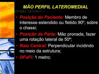 • Posição do Paciente: Membro de
interesse estendido ou fletido 90º, sobre
o chassi;
• Posição da Parte: Mão pronada, fazer
uma rotação lateral de 50º;
• Raio Central: Perpendicular incidindo
no meio da estrutura;
• DFoFi: 1 metro;
MÃO PERFIL LATEROMEDIAL
 