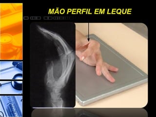 MÃO PERFIL EM LEQUE
 