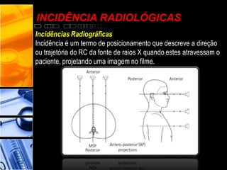 INCIDÊNCIA RADIOLÓGICAS
Incidências Radiográficas
Incidência é um termo de posicionamento que descreve a direção
ou trajetória do RC da fonte de raios X quando estes atravessam o
paciente, projetando uma imagem no filme.
 
