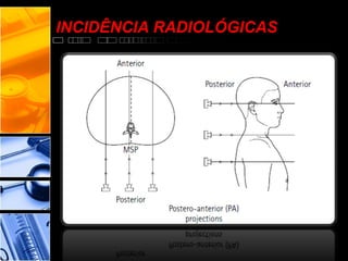 INCIDÊNCIA RADIOLÓGICAS
 