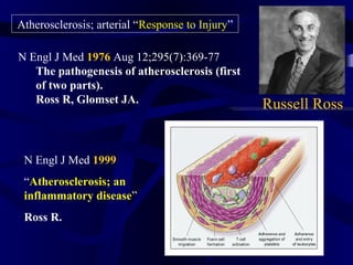 N Engl J Med 1999
“Atherosclerosis; an
inflammatory disease”
Ross R.
Russell Ross
Atherosclerosis; arterial “Response to Injury”
N Engl J Med 1976 Aug 12;295(7):369-77
The pathogenesis of atherosclerosis (first
of two parts).
Ross R, Glomset JA.
 