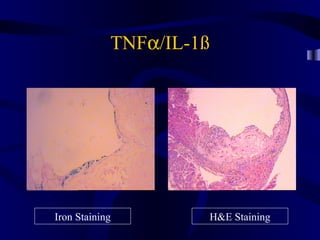 TNFα/IL-1ß
Iron Staining H&E Staining
 
