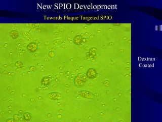 New SPIO Development
Towards Plaque Targeted SPIO
Dextran
Coated
 