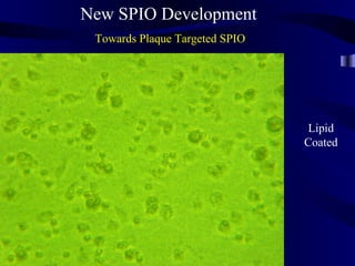 New SPIO Development
Towards Plaque Targeted SPIO
Lipid
Coated
 