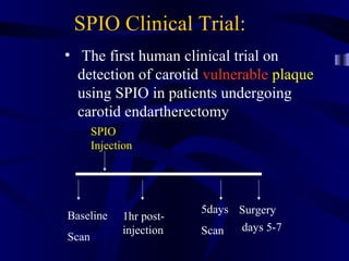 SPIO Clinical Trial:
• The first human clinical trial on
detection of carotid vulnerable plaque
using SPIO in patients undergoing
carotid endartherectomy
Baseline
Scan
SPIO
Injection
1hr post-
injection
5days
Scan
Surgery
days 5-7
 