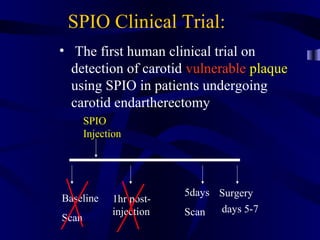 SPIO Clinical Trial:
• The first human clinical trial on
detection of carotid vulnerable plaque
using SPIO in patients undergoing
carotid endartherectomy
Baseline
Scan
SPIO
Injection
1hr post-
injection
5days
Scan
Surgery
days 5-7
 