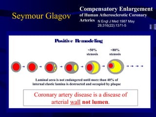Seymour Glagov
Compensatory Enlargement
of Human Atherosclerotic Coronary
Arteries N Engl J Med 1987 May
28;316(22):1371-5
<50%
stenosis
Luminal area is not endangered until more than 40% of
internal elastic lamina is destructed and occupied by plaque
Coronary artery disease is a disease of
arterial wall not lumen.
Positive Remodeling
<80%
stenosis
 