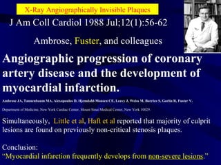 Angiographic progression of coronary
artery disease and the development of
myocardial infarction.
Ambrose JA, Tannenbaum MA, Alexopoulos D, Hjemdahl-Monsen CE, Leavy J, Weiss M, Borrico S, Gorlin R, Fuster V.
Department of Medicine, New York Cardiac Center, Mount Sinai Medical Center, New York 10029.
Simultaneously, Little et al, Haft et al reported that majority of culprit
lesions are found on previously non-critical stenosis plaques.
Conclusion:
“Myocardial infarction frequently develops from non-severe lesions.”
J Am Coll Cardiol 1988 Jul;12(1):56-62
Ambrose, Fuster, and colleagues
X-Ray Angiographically Invisible Plaques
 