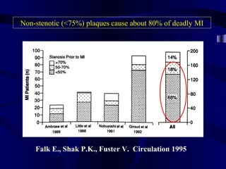 Falk E., Shak P.K., Fuster V. Circulation 1995
Non-stenotic (<75%) plaques cause about 80% of deadly MI
 