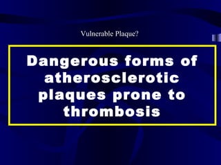 Dangerous forms of
atherosclerotic
plaques prone to
thrombosis
Vulnerable Plaque?
 