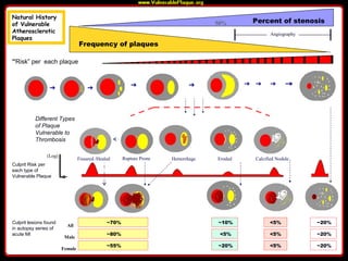 ~70%
Percent of stenosis
Frequency of plaques
“Risk” per each plaque
Culprit Risk per
each type of
Vulnerable Plaque
(Log)
Culprit lesions found
in autopsy series of
acute MI
Different Types
of Plaque
Vulnerable to
Thrombosis
All
Male
Female
~10% <5% ~20%
50%
Angiography
~80% <5% ~20%
~55% ~20%
<5%
<5% ~20%
Rupture Prone Eroded Calcified NoduleHemorrhage
Positive Remodeling
Fissured /Healed
Natural History
of Vulnerable
Atherosclerotic
Plaques
 