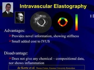 Intravascular Elastography
Advantages:
Provides novel information, showing stiffness
Small added cost to IVUS
Disadvantage:
Does not give any chemical – compositional data,
nor shows inflammation
de Korte et al. Thorax Center, Erasmus University Rotterdam
 