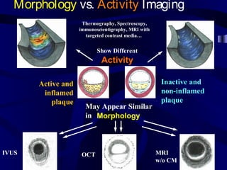 Morphology vs. Activity Imaging
Inactive and
non-inflamed
plaque
Active and
inflamed
plaque
May Appear Similar
in
IVUS OCT MRI
w/o CM
Morphology
Show Different
Activity
Thermography, Spectroscopy,
immunoscientigraphy, MRI with
targeted contrast media…
 