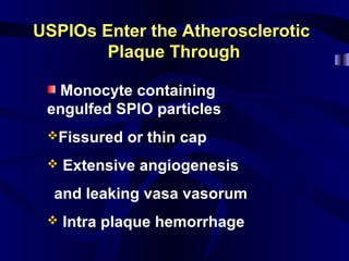 USPIOs Enter the AtheroscleroticUSPIOs Enter the Atherosclerotic
Plaque ThroughPlaque Through
Monocyte containing
engulfed SPIO particles
Fissured or thin cap
 Extensive angiogenesis
l and leaking vasa vasorum
 Intra plaque hemorrhage
 