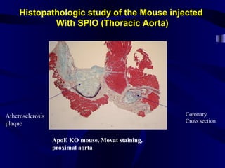 Histopathologic study of the Mouse injected
With SPIO (Thoracic Aorta)
ApoE KO mouse, Movat staining,
proximal aorta
Coronary
Cross section
Atherosclerosis
plaque
 