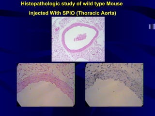 Histopathologic study of wild type Mouse
injected With SPIO (Thoracic Aorta)
H&E staining
CD68 stainingIron staining
 
