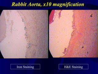 Rabbit Aorta, x10 magnification
Iron Staining H&E Staining
 