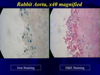 Rabbit Aorta, x40 magnified
Iron Staining H&E Staining
 