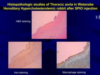 Histopathologic studies of Thoracic aorta in Watanabe
Hereditary Hypercholesterolemic rabbit after SPIO injection
H&E staining
Iron staining Macrophage staining
 