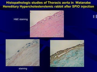 Histopathologic studies of Thoracic aorta in Watanabe
Hereditary Hypercholesterolemic rabbit after SPIO injection
H&E staining
Iron staining
Iron staining
Iron particles
 
