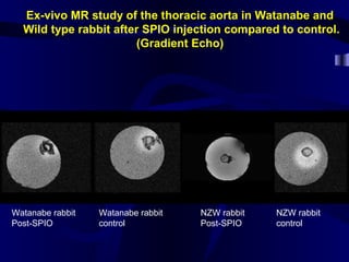 Ex-vivo MR study of the thoracic aorta in Watanabe and
Wild type rabbit after SPIO injection compared to control.
(Gradient Echo)
Watanabe rabbit
Post-SPIO
Watanabe rabbit
control
NZW rabbit
Post-SPIO
NZW rabbit
control
 