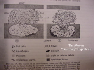 The Abscess
“Grutzbalg” Hypothesis
 