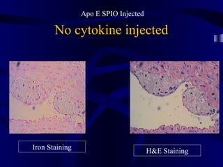 No cytokine injected
Apo E SPIO Injected
Iron Staining
H&E Staining
 