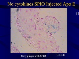 No cytokines SPIO Injected Apo E
Only plaque with SPIO C3Ex40
 