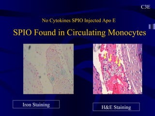 No Cytokines SPIO Injected Apo E
C3E
SPIO Found in Circulating Monocytes
Iron Staining
H&E Staining
 