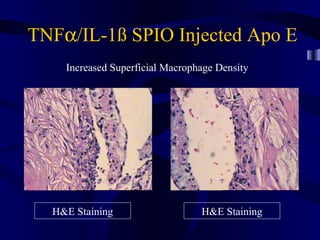 TNFα/IL-1ß SPIO Injected Apo E
H&E StainingH&E Staining
Increased Superficial Macrophage Density
 