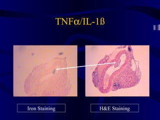 TNFα/IL-1ß
Iron Staining H&E Staining
 