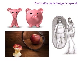 Distorsión de la imagen corporal
 