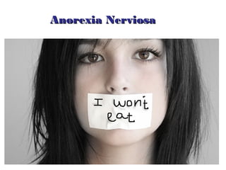 Anorexia Nerviosa
 