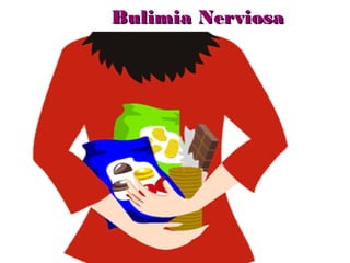 Bulimia Nerviosa
 