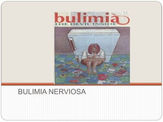 BULIMIA NERVIOSA
 