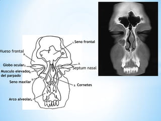 Seno frontal 
Globo ocular 
Musculo elevador del parpado 
Seno maxilar 
Arco alveolar 
Cornetes 
Hueso frontal 
Septum nasal  
