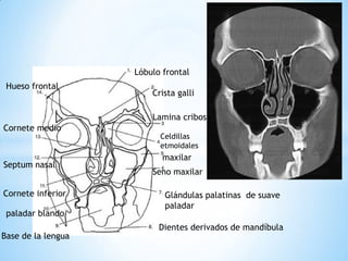 Lóbulo frontal 
Crista galli 
Seno maxilar 
Base de la lengua 
maxilar 
Hueso frontal 
Cornete medio 
Celdillas 
etmoidales 
Glándulas palatinas de suave paladar 
Dientes derivados de mandíbula 
paladar blando 
Cornete inferior 
Septum nasal 
Lamina cribosa  