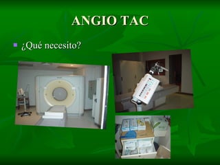 ANGIO TAC ,[object Object]