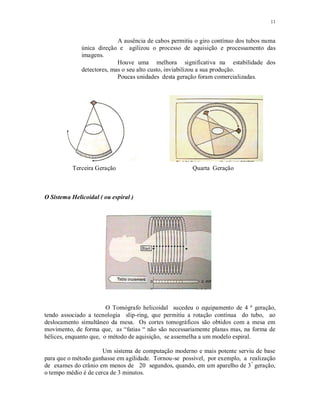 11
A ausência de cabos permitiu o giro contínuo dos tubos numa
única direção e agilizou o processo de aquisição e processamento das
imagens.
Houve uma melhora significativa na estabilidade dos
detectores, mas o seu alto custo, inviabilizou a sua produção.
Poucas unidades desta geração foram comercializadas.
Terceira Geração Quarta Geração
O Sistema Helicoidal ( ou espiral )
O Tomógrafo helicoidal sucedeu o equipamento de 4 ª geração,
tendo associado a tecnologia slip-ring, que permitiu a rotação contínua do tubo, ao
deslocamento simultâneo da mesa. Os cortes tomográficos são obtidos com a mesa em
movimento, de forma que, as “fatias “ não são necessariamente planas mas, na forma de
hélices, enquanto que, o método de aquisição, se assemelha a um modelo espiral.
Um sistema de computação moderno e mais potente serviu de base
para que o método ganhasse em agilidade. Tornou-se possível, por exemplo, a realização
de exames do crânio em menos de 20 segundos, quando, em um aparelho de 3ª
geração,
o tempo médio é de cerca de 3 minutos.
 