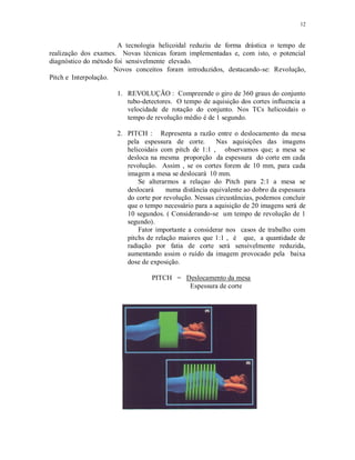 12
A tecnologia helicoidal reduziu de forma drástica o tempo de
realização dos exames. Novas técnicas foram implementadas e, com isto, o potencial
diagnóstico do método foi sensivelmente elevado.
Novos conceitos foram introduzidos, destacando-se: Revolução,
Pitch e Interpolação.
1. REVOLUÇÃO : Compreende o giro de 360 graus do conjunto
tubo-detectores. O tempo de aquisição dos cortes influencia a
velocidade de rotação do conjunto. Nos TCs helicoidais o
tempo de revolução médio é de 1 segundo.
2. PITCH : Representa a razão entre o deslocamento da mesa
pela espessura de corte. Nas aquisições das imagens
helicoidais com pitch de 1:1 , observamos que; a mesa se
desloca na mesma proporção da espessura do corte em cada
revolução. Assim , se os cortes forem de 10 mm, para cada
imagem a mesa se deslocará 10 mm.
Se alterarmos a relaçao do Pitch para 2:1 a mesa se
deslocará numa distância equivalente ao dobro da espessura
do corte por revolução. Nessas circustâncias, podemos concluir
que o tempo necessário para a aquisição de 20 imagens será de
10 segundos. ( Considerando-se um tempo de revolução de 1
segundo).
Fator importante a considerar nos casos de trabalho com
pitchs de relação maiores que 1:1 , é que, a quantidade de
radiação por fatia de corte será sensivelmente reduzida,
aumentando assim o ruído da imagem provocado pela baixa
dose de exposição.
PITCH = Deslocamento da mesa
Espessura de corte
 